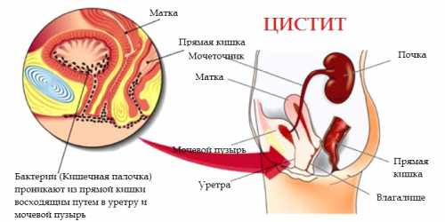 профилактика болезни альцгеймера: 5 рекомендаций